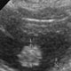B-scan