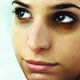 حلقه سیاه؛ مهمان ناخوانده چشم‌ها