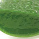 درمان خانگی سوختگی‌ ها