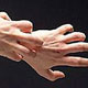 خارش زدایی